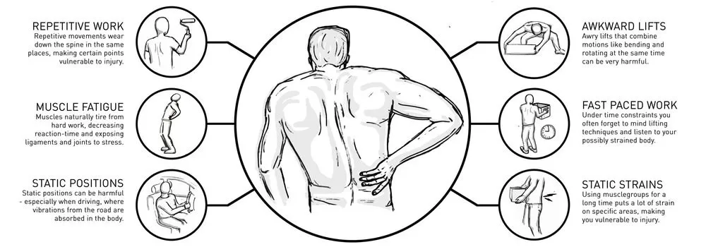 Six common causes of work-related back pain: repetitive work, muscle fatigue, static positions, awkward lifts, fast-paced work and static strains